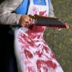 Amputation at field hospital photo review